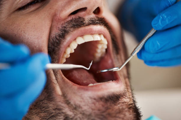 Best Mobile Emergency Dentist in Tuttle, OK